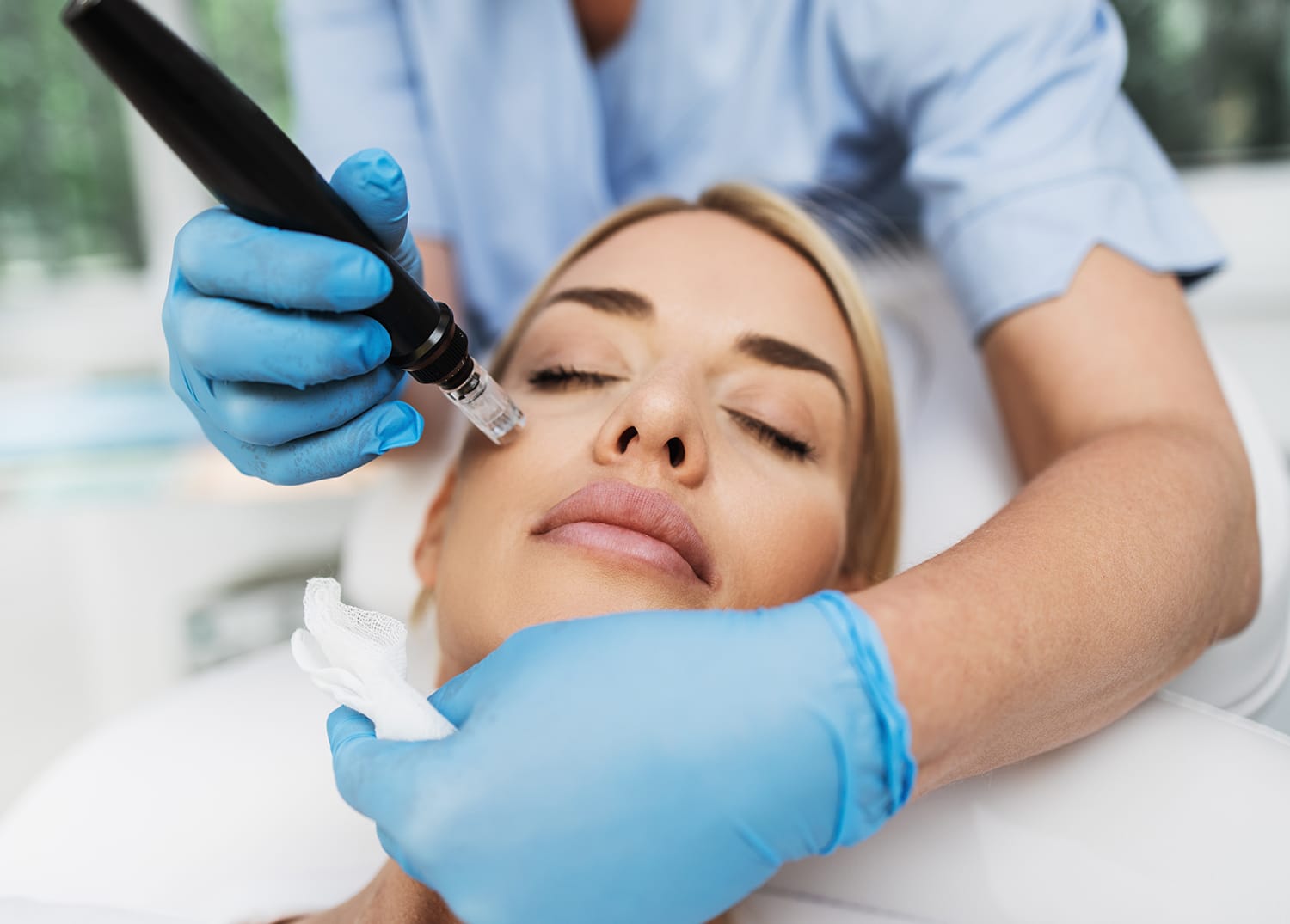Beautiful blond woman receiving microneedling