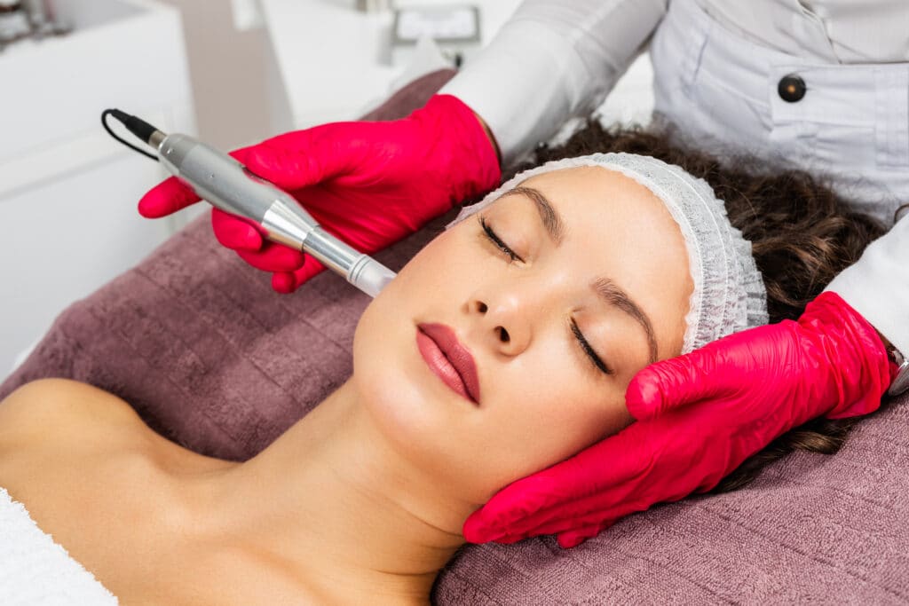 PRP Microneedling in NYC Perfect Med Spa